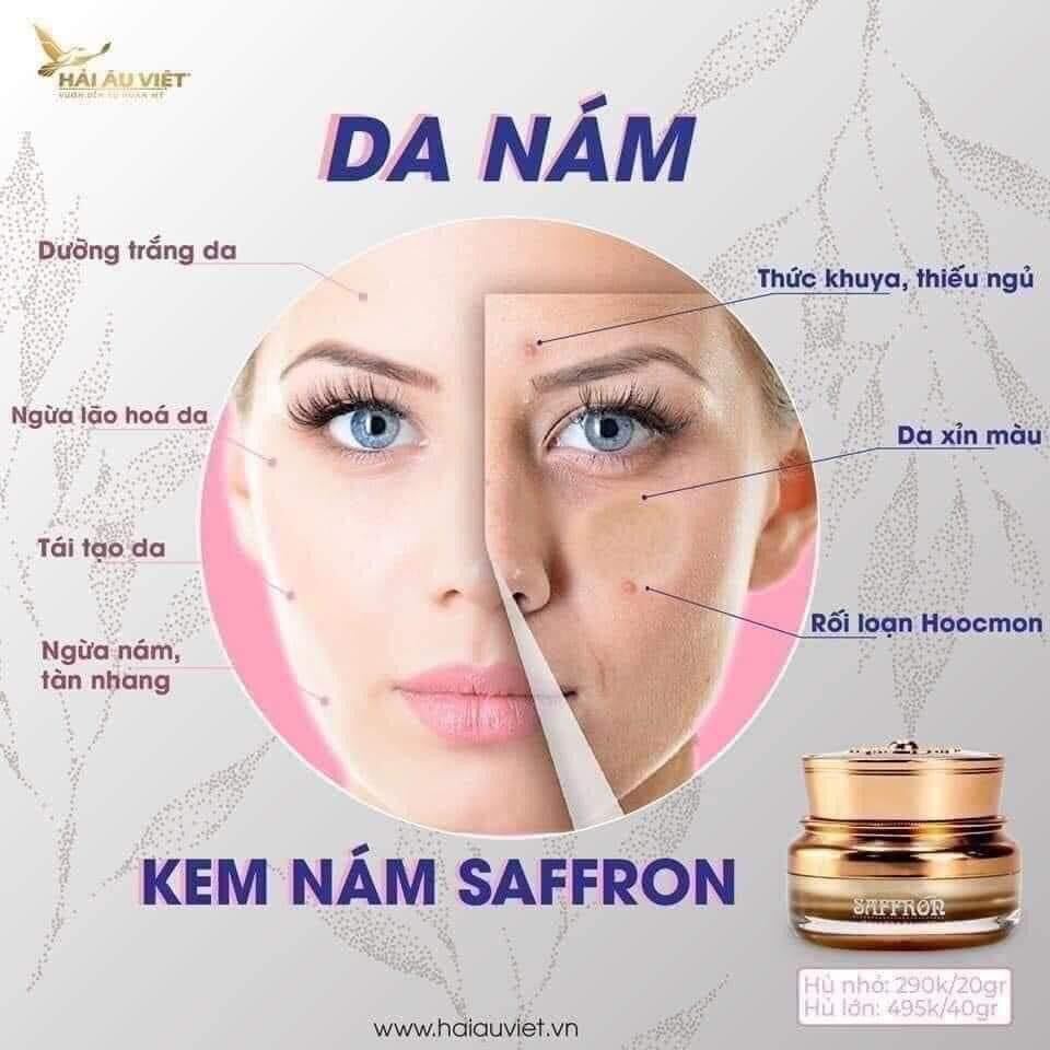 Kem nám Saffron Hải Âu Việt phù hợp với loại da nào?